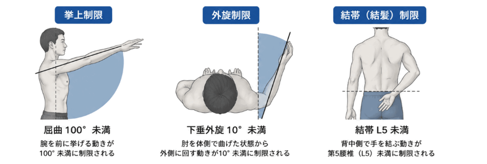 凍結肩の身体診察